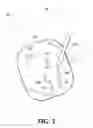 Fig. 13 - Treating degenerative dementia with low intensity focused ultrasound pulsation (LIFUP) device