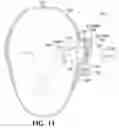 Fig. 19 - Treating degenerative dementia with low intensity focused ultrasound pulsation (LIFUP) device