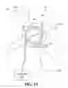 Fig. 20 - Treating degenerative dementia with low intensity focused ultrasound pulsation (LIFUP) device