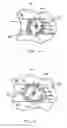 Fig. 08 - Golf club having removeable weight