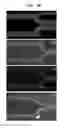 Fig. 41 - SYSTEMS AND METHODS FOR PARTICLE FOCUSING IN MICROCHANNELS