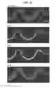 Fig. 44 - SYSTEMS AND METHODS FOR PARTICLE FOCUSING IN MICROCHANNELS