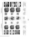 Fig. 11 - INTERPENETRATING PHASE COMPOSITE STRUCTURES INCLUDING TRIPLY PERIODIC MINIMAL SURFACES AND METHODS OF FORMING THE SAME