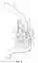 Fig. 06 - Headrest assembly for a vehicle seat