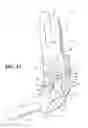 Fig. 14 - Headrest assembly for a vehicle seat