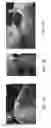 Fig. 02 - Backrest speakers with acoustic channels