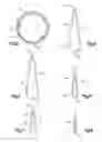 Fig. 03 - TURBINE BLADE DISPOSAL SYSTEM