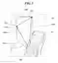 Fig. 09 - Self standing center side airbag