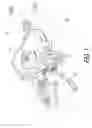 Fig. 02 - Bicycle operating device