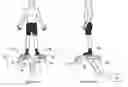 Fig. 01 - PERSONAL PROPULSION DEVICES WITH IMPROVED BALANCE