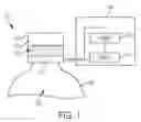 Fig. 02 - Closure device