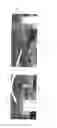 Fig. 05 - CONTAINER FOR TRANSPORTING AND/OR STORING A PLURALITY OF GLASS SHEETS