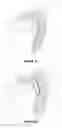 Fig. 06 - Device and method for winding an excess length of an optical fiber onto a bobbin