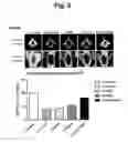 Fig. 09 - Composition comprising recombinant fusion protein of pathogenic antigen protein and flagellin of vibrio vulnificus for preventing, alleviating, or treating aging