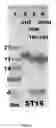 Fig. 06 - Method of preparing glucagon-like peptide-2 (GLP-2) analog