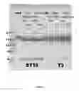 Fig. 07 - Method of preparing glucagon-like peptide-2 (GLP-2) analog
