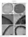 Fig. 05 - COMPOSITIONS COMPRISING YEAST CELLS AND POLYPHENOLS AND THEIR USE