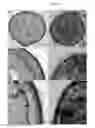 Fig. 06 - COMPOSITIONS COMPRISING YEAST CELLS AND POLYPHENOLS AND THEIR USE