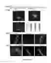 Fig. 07 - Methods of maintaining, expanding, and differentiating neuronal subtype specific progenitors