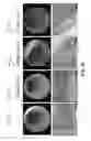 Fig. 13 - Compositions and methods for diminishing an immune response