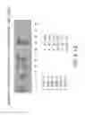 Fig. 32 - Isolation and cultivation of stem/progenitor cells from the amniotic membrane of umbilical cord and uses of cells differentiated therefrom