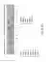 Fig. 37 - Isolation and cultivation of stem/progenitor cells from the amniotic membrane of umbilical cord and uses of cells differentiated therefrom
