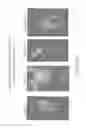 Fig. 46 - Isolation and cultivation of stem/progenitor cells from the amniotic membrane of umbilical cord and uses of cells differentiated therefrom