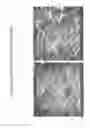 Fig. 82 - Isolation and cultivation of stem/progenitor cells from the amniotic membrane of umbilical cord and uses of cells differentiated therefrom