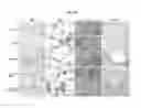 Fig. 03 - Methods for treating acute myeloid leukemia and nanoparticle complexes of miR-22 utilized therein