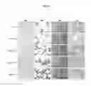 Fig. 09 - Methods for treating acute myeloid leukemia and nanoparticle complexes of miR-22 utilized therein