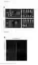 Fig. 02 - Nucleic acid molecule encoding glei protein variant with increased phytic acid sensitivity and use thereof