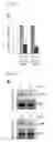 Fig. 04 - Nucleic acid molecule encoding glei protein variant with increased phytic acid sensitivity and use thereof