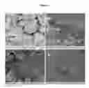 Fig. 02 - Cementation methods