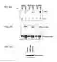 Fig. 04 - Mutations of the PIK3CA gene in human cancers