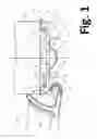 Fig. 02 - DOOR SWEEP AND METHOD FOR INSTALLING A DOOR SWEEP