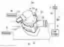 Fig. 01 - Bypass valve apparatus