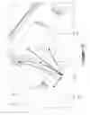 Fig. 06 - GAS TURBINE ENGINE WITH BLEED SLOTS AND METHOD OF FORMING
