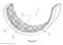 Fig. 02 - Bearing material, bearing and method