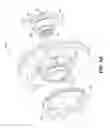 Fig. 06 - Narrow packaging locking differential