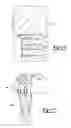 Fig. 15 - Crankshaft balancer suspension assembly