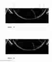 Fig. 04 - Contact lens inspection method and system