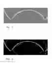 Fig. 05 - Contact lens inspection method and system