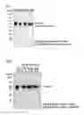 Fig. 02 - Tim protein-bound carrier, methods for obtaining, removing and detecting extracellular membrane vesicles and viruses using said carrier, and kit including said carrier