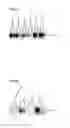 Fig. 09 - Tim protein-bound carrier, methods for obtaining, removing and detecting extracellular membrane vesicles and viruses using said carrier, and kit including said carrier