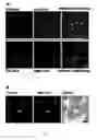 Fig. 02 - Fluorescent polybranched probes for detecting bacteria and/or fungi in vitro and in vivo