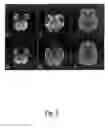 Fig. 06 - Magnetic resonance diffusion weighted imaging method and apparatus