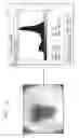 Fig. 04 - Detection of outlier lesions based on extracted features from skin images