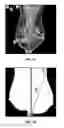 Fig. 02 - Systems and user interfaces for determination of electro magnetically identified lesions as included in medical images of differing perspectives