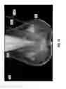 Fig. 08 - Systems and user interfaces for determination of electro magnetically identified lesions as included in medical images of differing perspectives