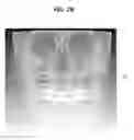Fig. 04 - Method, apparatus and program for selective registration three-dimensional tooth image data to optical scanning tooth model